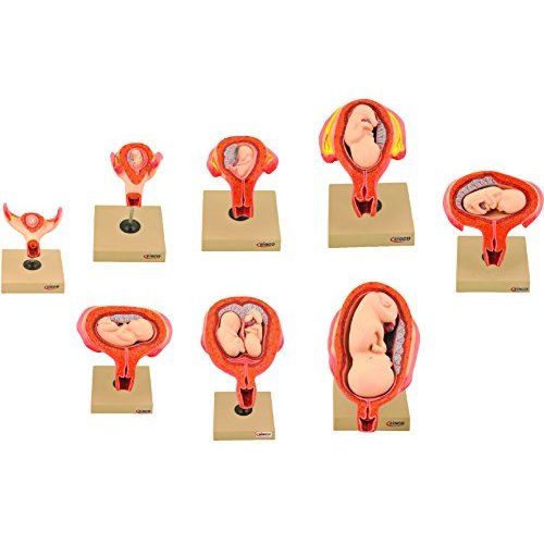 مولاژ نوزاد (مراحل حاملگی)